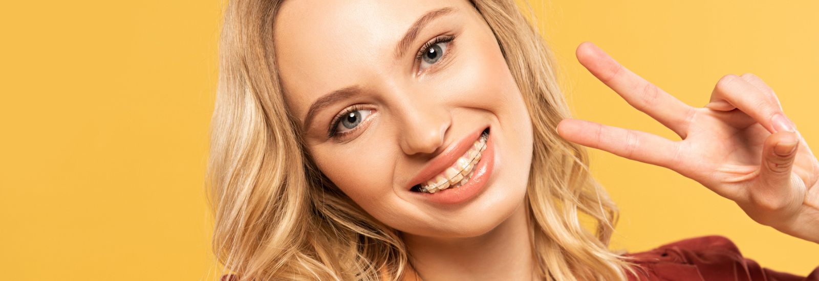 Smiling woman with dental braces - Orthodontic Treatment